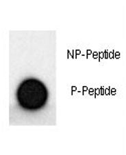 Phospho-MAP2 Antibody (pS1539)