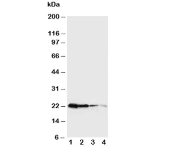 Growth Hormone Antibody (Mouse)