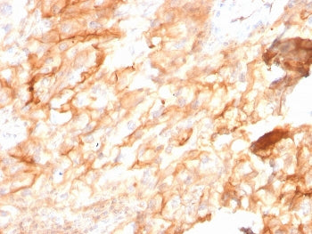 IHC staining of FFPE human kidney with CD10 antibody (clone MME/2590). HIER: boil tissue sections in