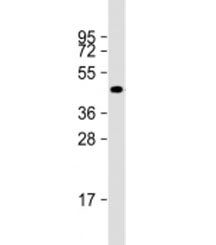 NAT16 Antibody / C7orf52