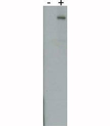 PARK8 Antibody (LRRK2)