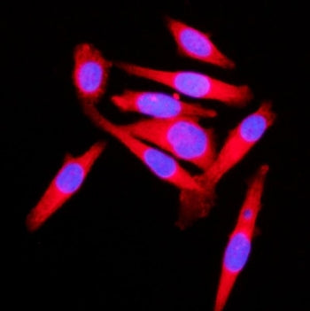 Immunofluorescent staining of FFPE human PC-3 cells with KLC1 antibody (red) and DAPI nuclear stain 