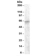 IGF2BP2 Antibody