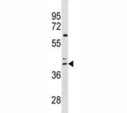 CCR4 Antibody