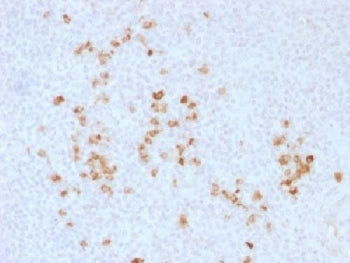 IgG Heavy Chain Antibody