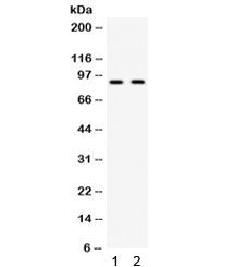 Western blot testing of 1) mouse testis and 2) human HeLa lysate with CIP2A antibody. Routinely obse