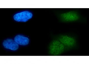 MSL2 Antibody / Male-specific lethal-2 homolog