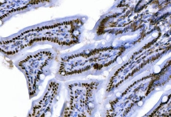 IHC staining of FFPE mouse colon tissue with C-terminal-binding protein 2 antibody. HIER: boil tissu