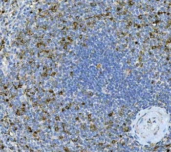Interleukin 17A Antibody