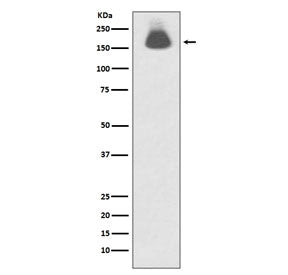Phospho-EGF Receptor / EGFR Antibody (pS695)