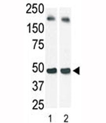 SPHK1 Antibody