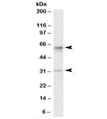 SLC17A5 Antibody