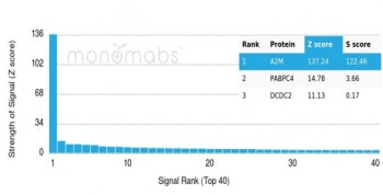 A2M Antibody / Alpha-2-Macroglobulin