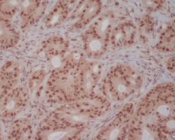PI3K Antibody (p85 beta) / PIK3R2