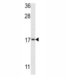 LC3B Antibody (MAP1LC3B)