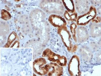 IHC staining of FFPE human kidney tissue with PVALB antibody (clone PVALB/7601). Inset: PBS used in 