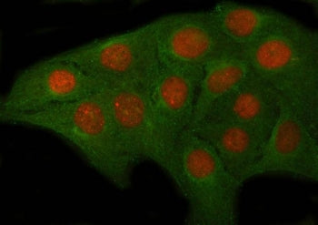OVOL2 Antibody / Ovo-like 2