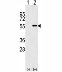 NUP50 Antibody