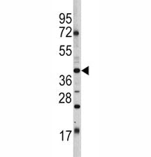 Oct4 Antibody (POU5F1)