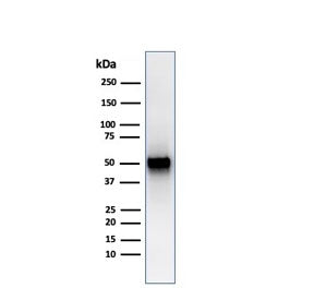 Thymidine Phosphorylase Antibody / PD-ECGF