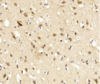 IHC testing of FFPE human brain tissue with Lingo1 antibody. HIER: steam section in pH6 citrate buff