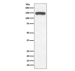 Western blot testing of human brain lysate with Collagen VI antibody. Predicted molecular weight ~10
