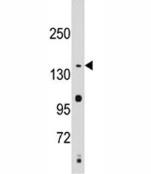 SMC2 Antibody