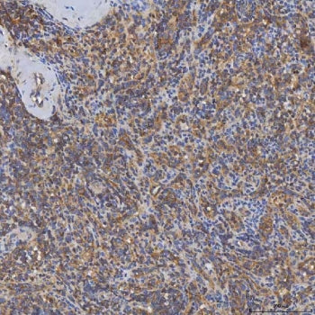 IHC staining of FFPE human spleen tissue with SHQ1 antibody. HIER: boil tissue sections in pH8 EDTA 