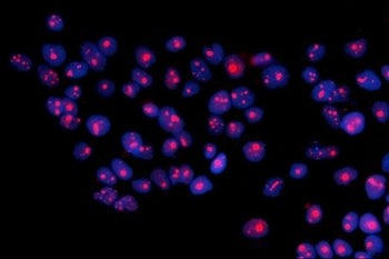 Immunofluorescent staining of FFPE human A431 cells with RRS1 antibody (red) and DAPI nuclear stain 