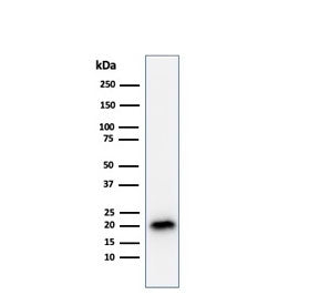 Western blot testing of human COLO-38 cell lysate with recombinant Melan-A antibody (clone A103). Ex