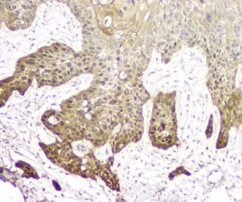14-3-3 sigma Antibody