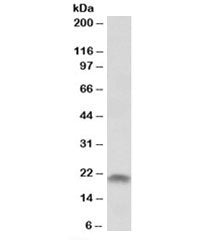 Western blot testing of human placenta lysate with SPINT2 antibody at 1ug/ml. Predicted molecular we