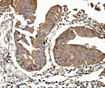 TAB2 Antibody