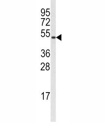 Cyclin B1 Antibody (CCNB1)