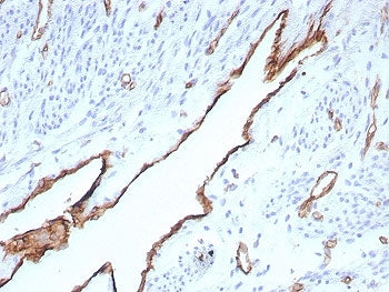 IHC staining of FFPE human placental tissue with CD31 antibody (clone rPECAM1/8832). HIER: boil tiss