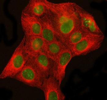 DHX15 Antibody / Prp43