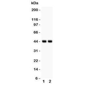 Western blot testing of RUNX3 antibody and human lysates 1. A431 and 2. U-2 0S. Predicted molecular 