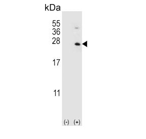 HPRT1 Antibody / HGPRT1