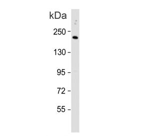 Western blot testing of human HepG2 cell lysate with C4B antibody. Predicted molecular weight ~193 k