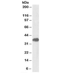 FOXF1 Antibody