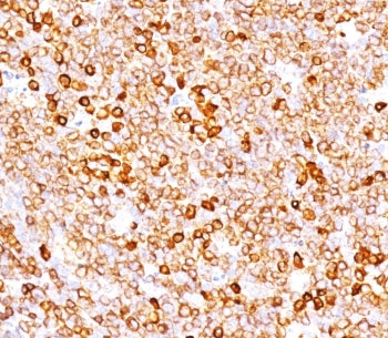 CD79a Antibody