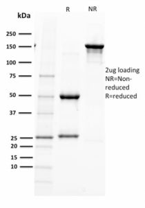 SDS-PAGE analysis of purified, BSA-free PAX5 antibody (PAX5/2595) as confirmation of integrity and p