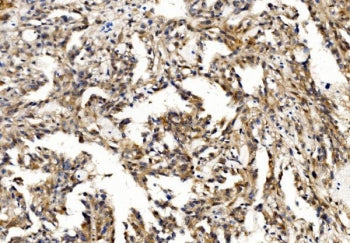 PFN2 Antibody / Profilin 2