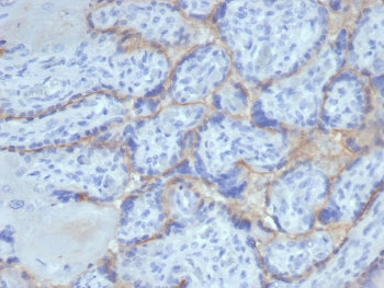 IHC staining of FFPE human placental tissue with recombinant EGF Receptor antibody (clone rEGFR/6389