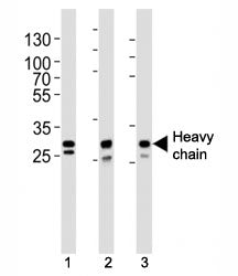 Western blot analysis of lysate from (1) A431, (2) MCF-7, (3) SK-BR-3 cell line using Cathepsin D an