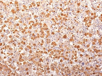IHC: Formalin-fixed, paraffin-embedded human pituitary gland stained with ACTH antibody (AH26 + 57).