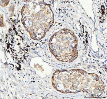 M6PR Antibody / IGF2R
