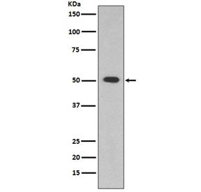 ALDH1A1 Antibody