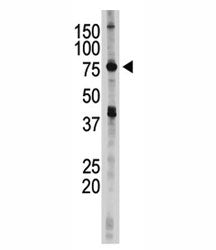 IKK epsilon Antibody (IKKE)