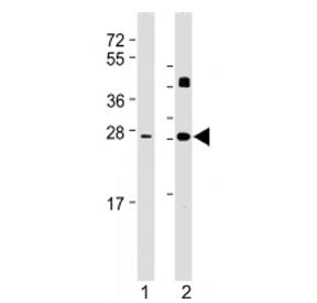 DKK2 Antibody